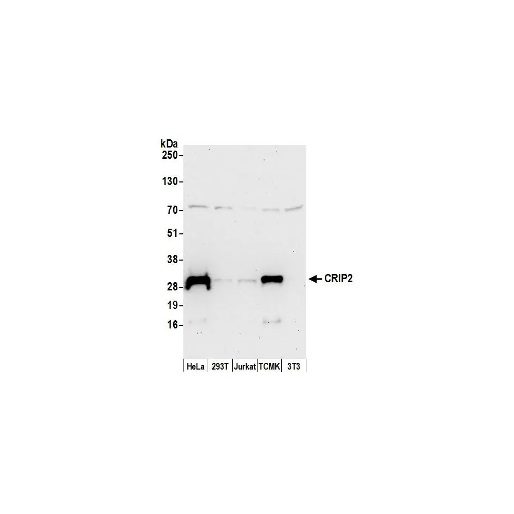 Rabbit anti-CRIP2 Antibody, Affinity Purified