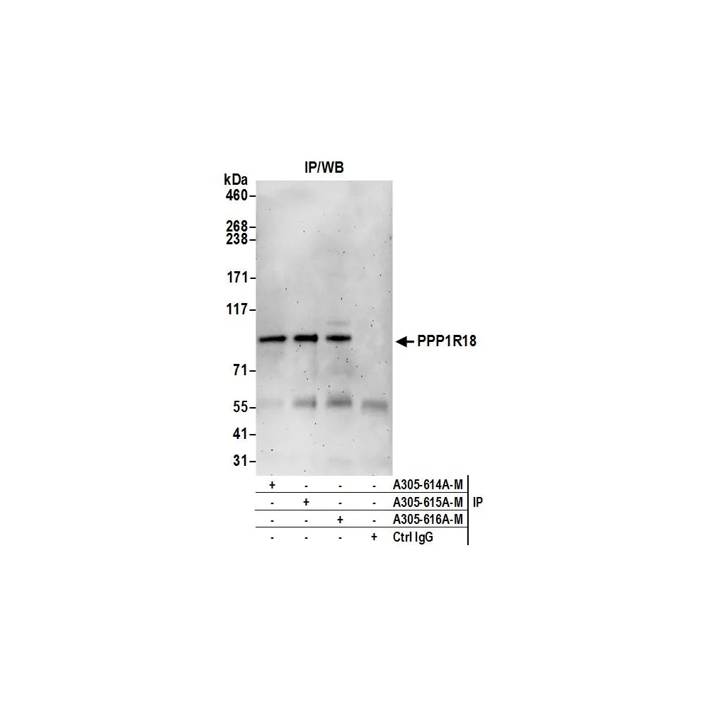 Rabbit anti-PPP1R18 Antibody, Affinity Purified