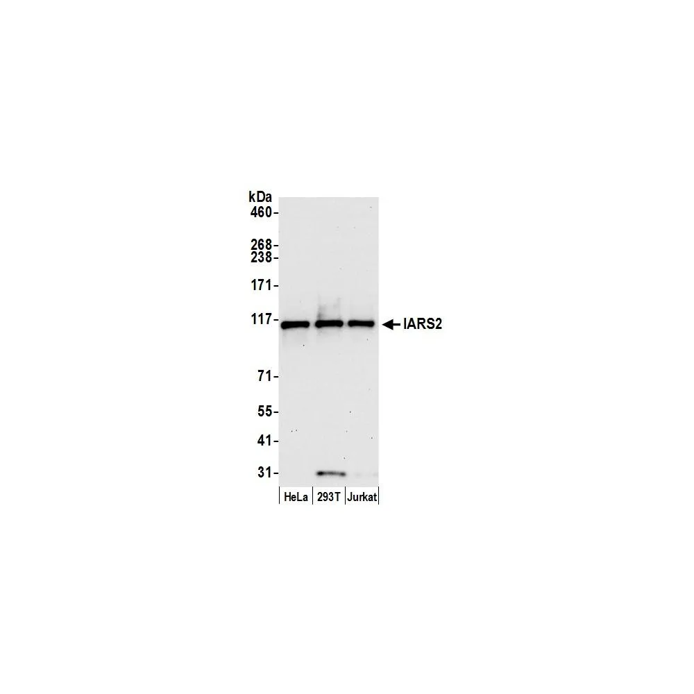 Rabbit anti-IARS2 Antibody, Affinity Purified