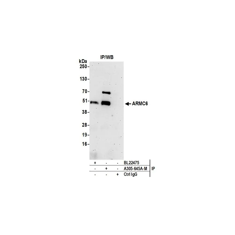 Rabbit anti-ARMC6 Antibody, Affinity Purified