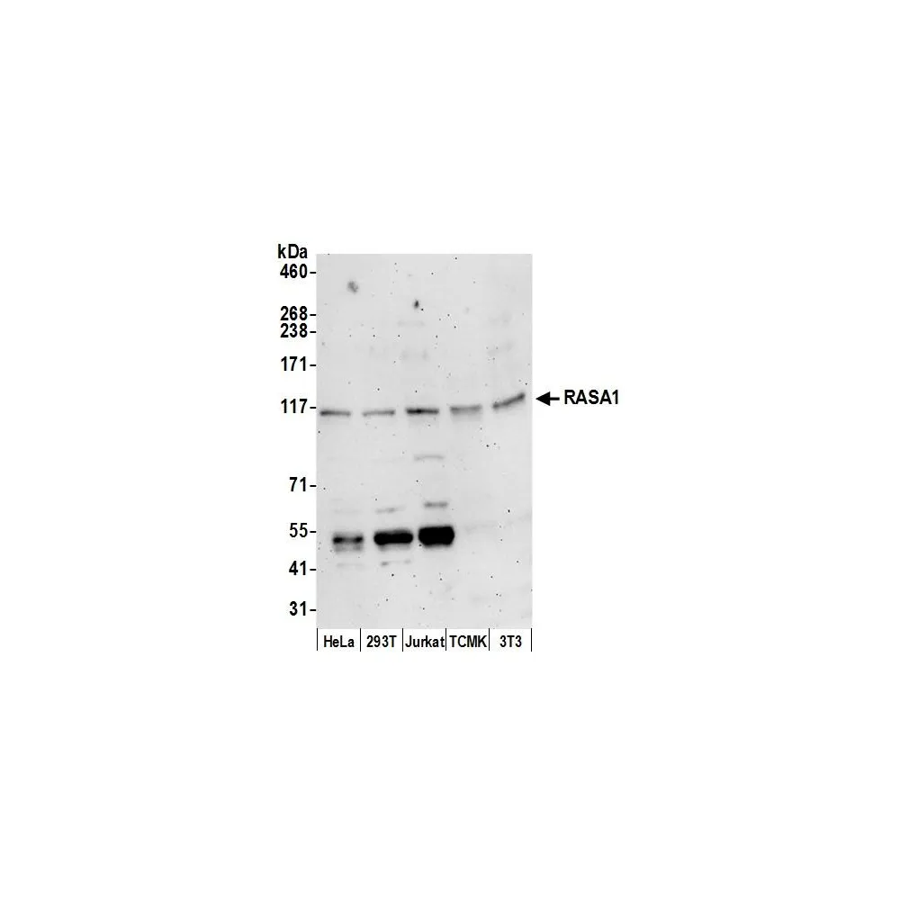 Rabbit anti-RASA1 Antibody, Affinity Purified