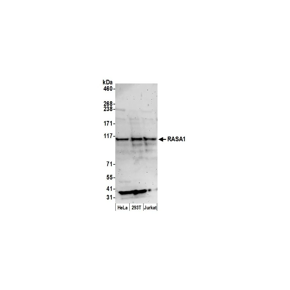 Rabbit anti-RASA1 Antibody, Affinity Purified