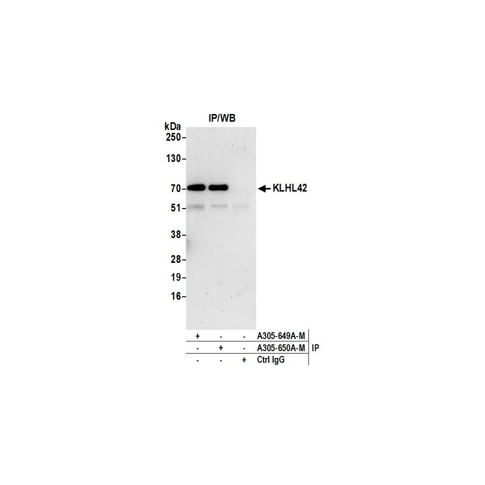 Rabbit anti-KLHL42 Antibody, Affinity Purified