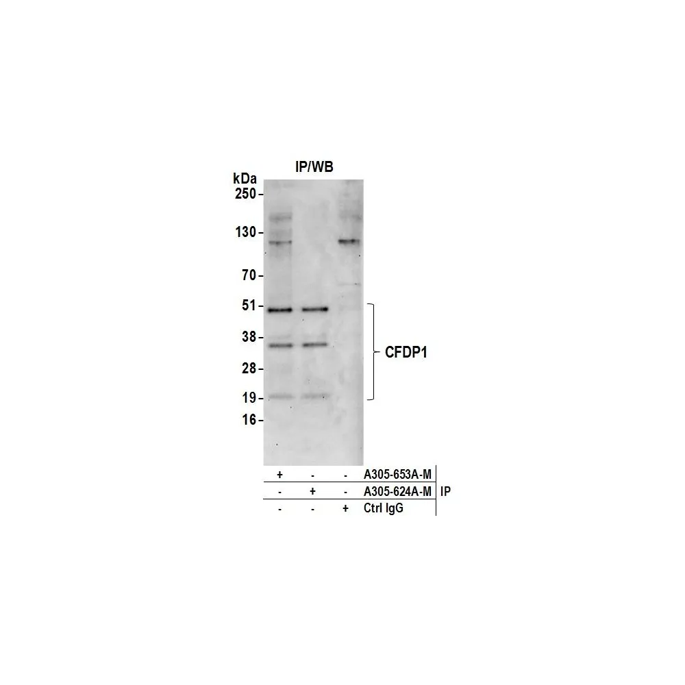 Rabbit anti-CFDP1 Antibody, Affinity Purified