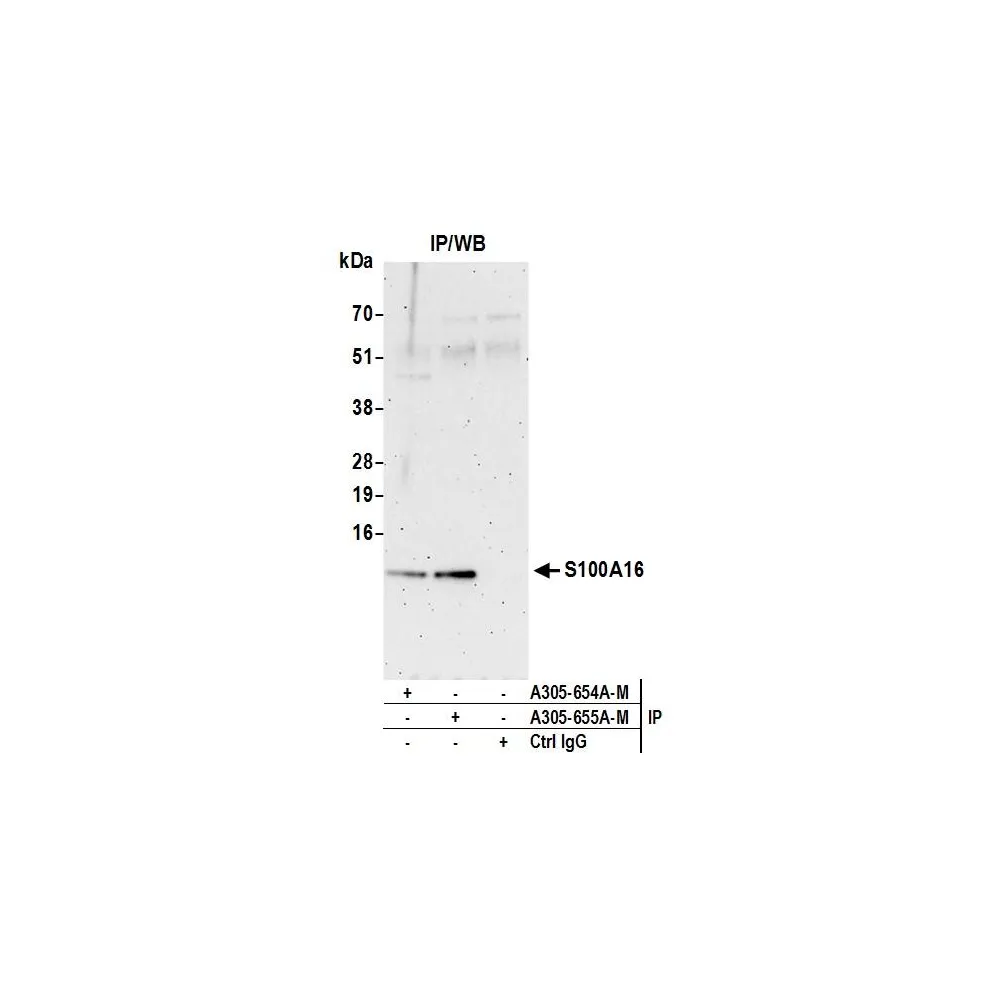 Rabbit anti-S100A16 Antibody, Affinity Purified