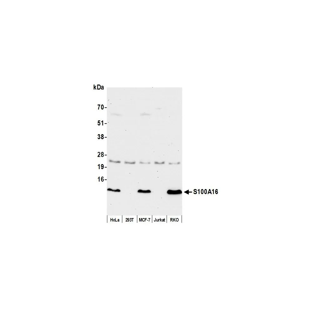 Rabbit anti-S100A16 Antibody, Affinity Purified