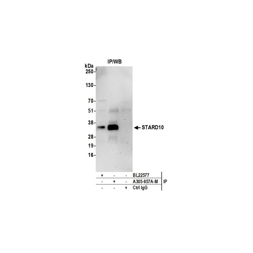 Rabbit anti-STARD10 Antibody, Affinity Purified
