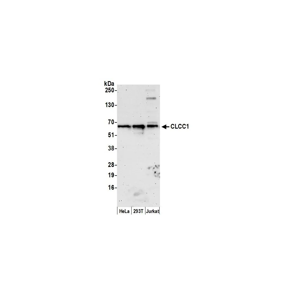 Rabbit anti-CLCC1 Antibody, Affinity Purified