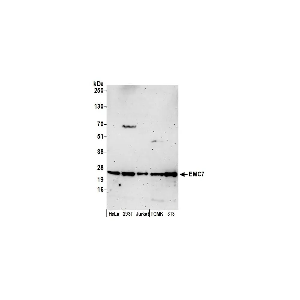 Rabbit anti-EMC7 Antibody, Affinity Purified