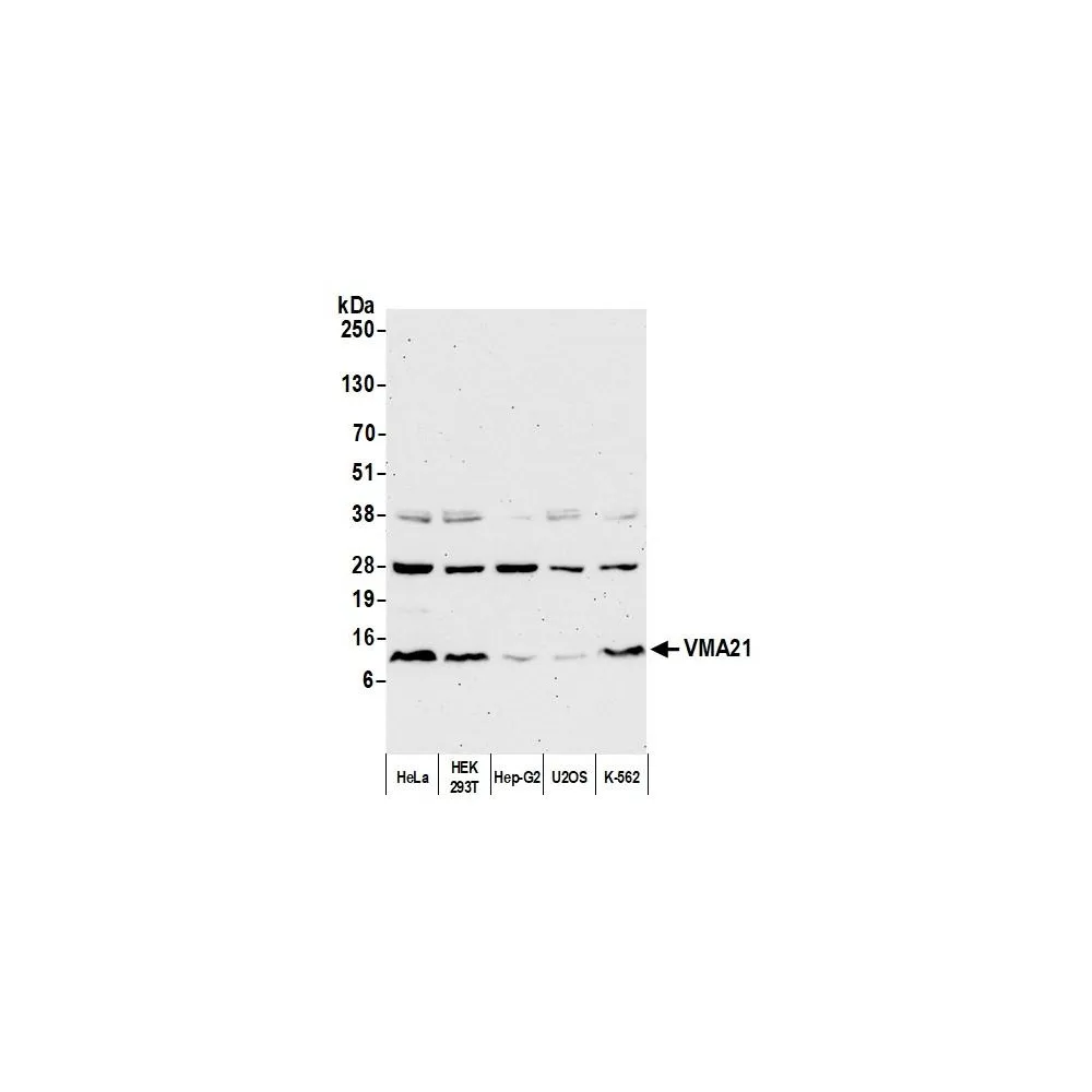 Rabbit anti-VMA21 Antibody, Affinity Purified