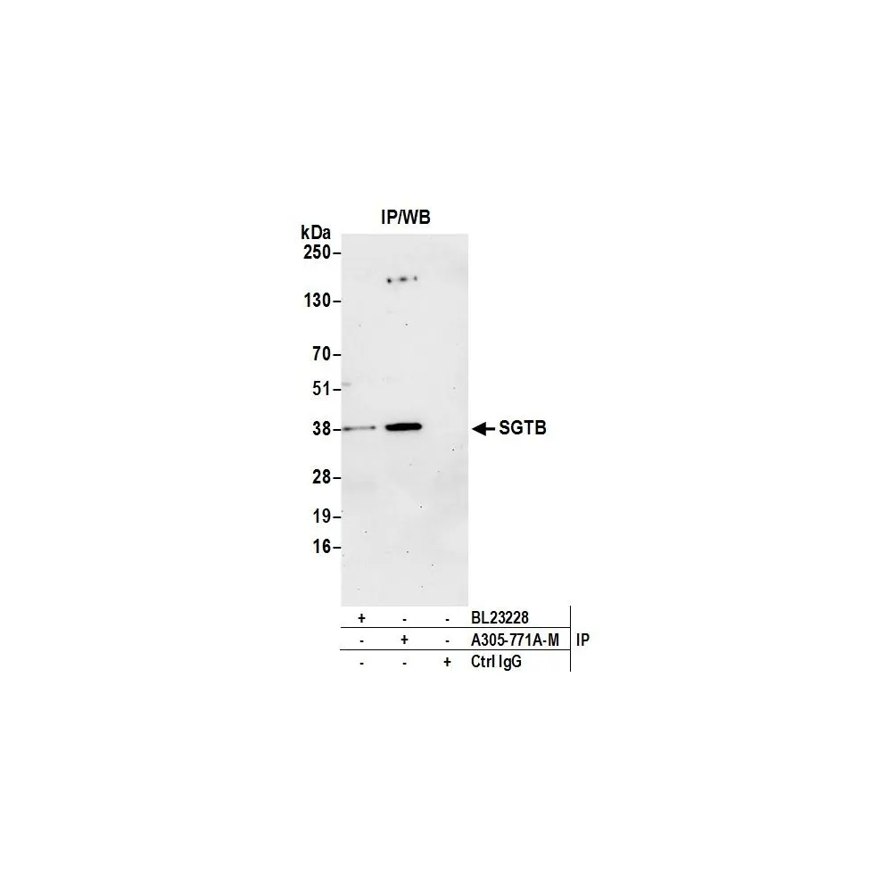 Rabbit anti-SGTB Antibody, Affinity Purified