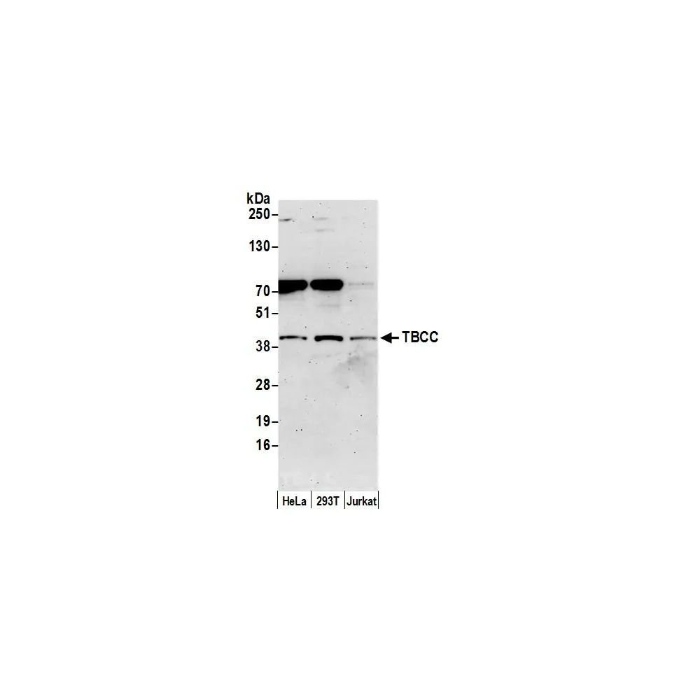 Rabbit anti-TBCC Antibody, Affinity Purified