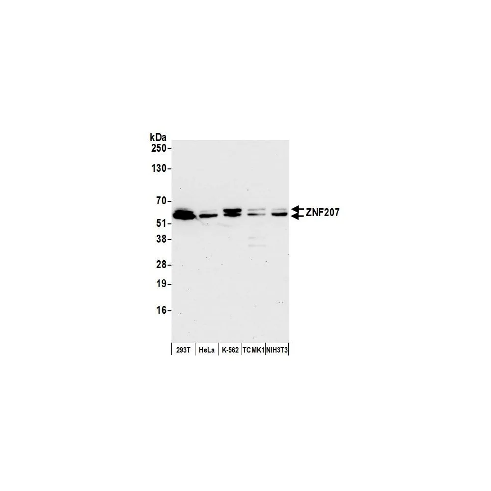 Rabbit anti-ZNF207 Antibody, Affinity Purified