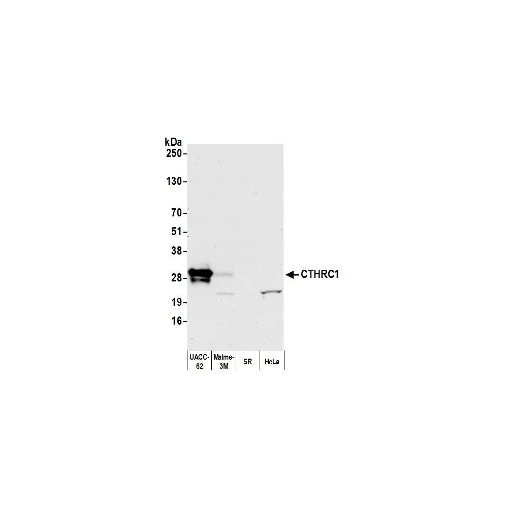 Rabbit anti-CTHRC1 Antibody, Affinity Purified