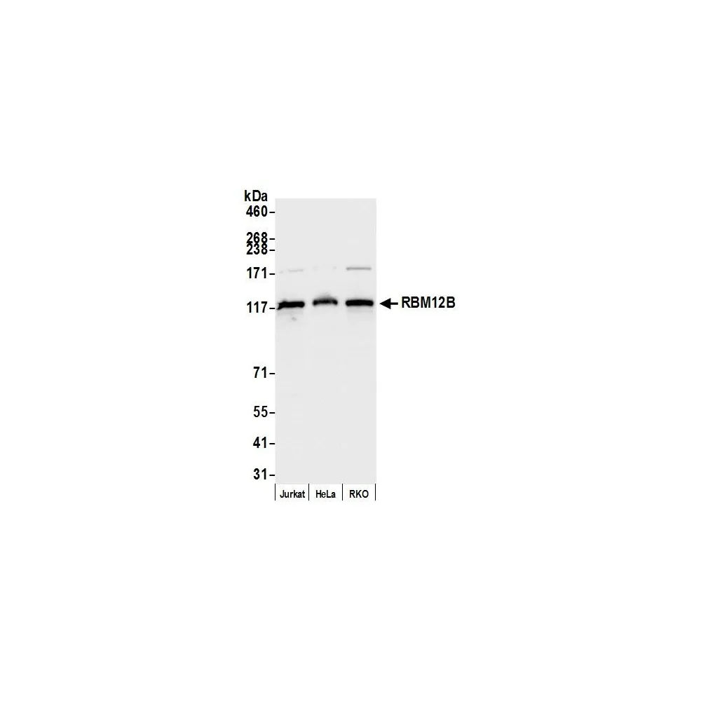 Rabbit anti-RBM12B Antibody, Affinity Purified