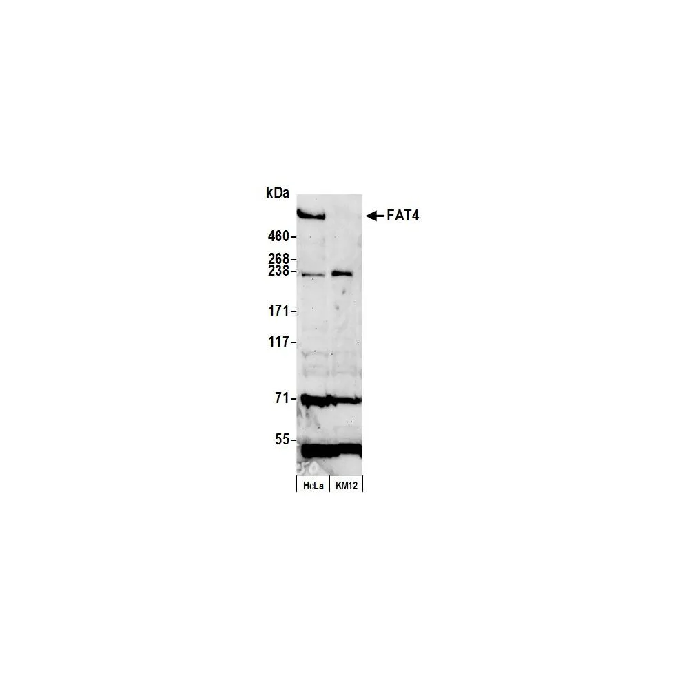 Rabbit anti-FAT4 Antibody, Affinity Purified