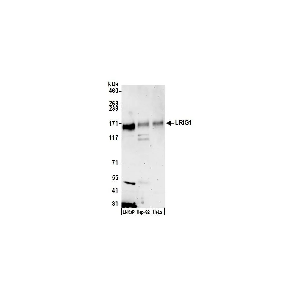 Rabbit anti-LRIG1 Antibody, Affinity Purified