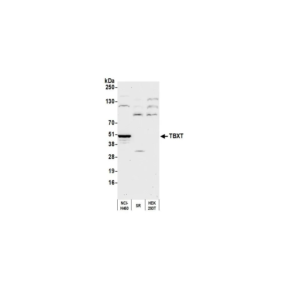 Rabbit anti-TBXT Antibody, Affinity Purified
