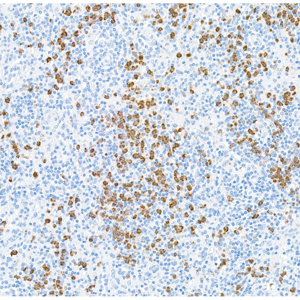 Mouse anti-CD15 Monoclonal Antibody [MMA(Leu-M1)]