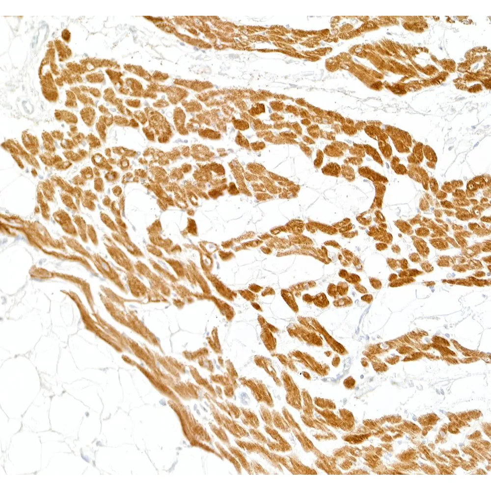 Mouse anti-Cardiac Troponin I Monoclonal Antibody [2I-14]