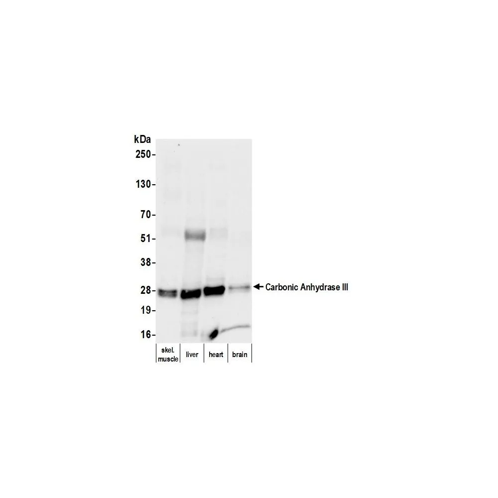 Mouse anti-Carbonic Anhydrase III Monoclonal Antibody [2CA-4]