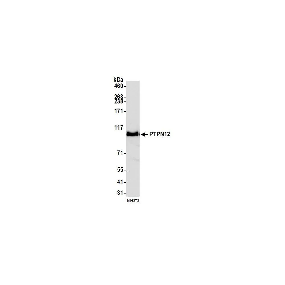 Rabbit anti-PTPN12 Recombinant Monoclonal Antibody [BL-5-2F8]