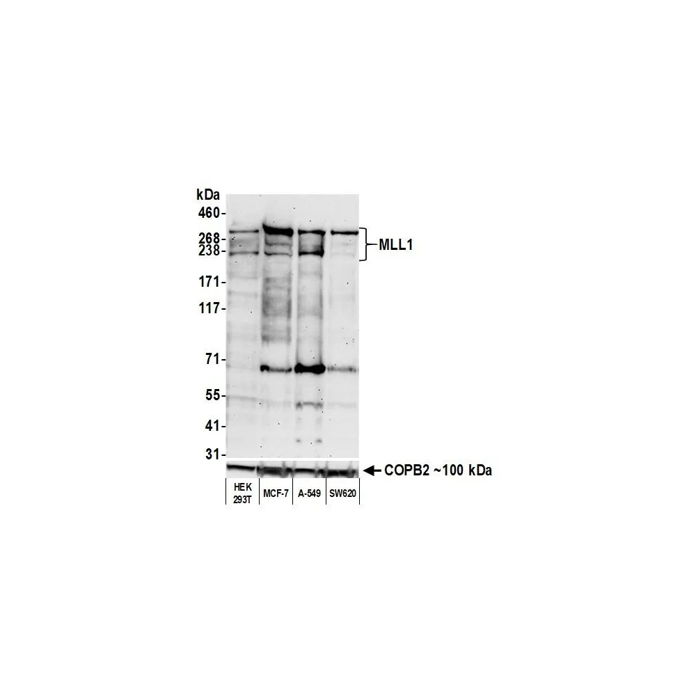 Rabbit anti-MLL1 Recombinant Monoclonal Antibody [BL-175-7E8]