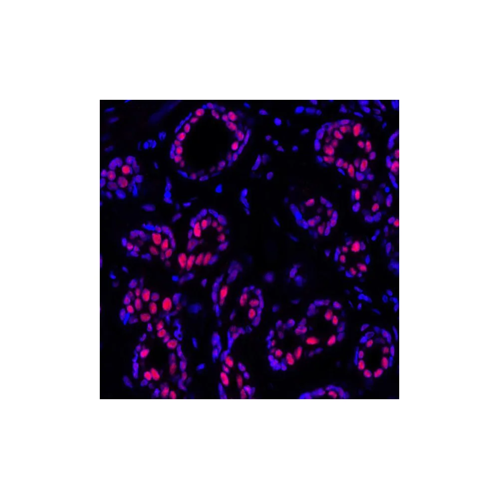 Rabbit anti-PBRM1 Recombinant Monoclonal Antibody [BL-39-2C3]