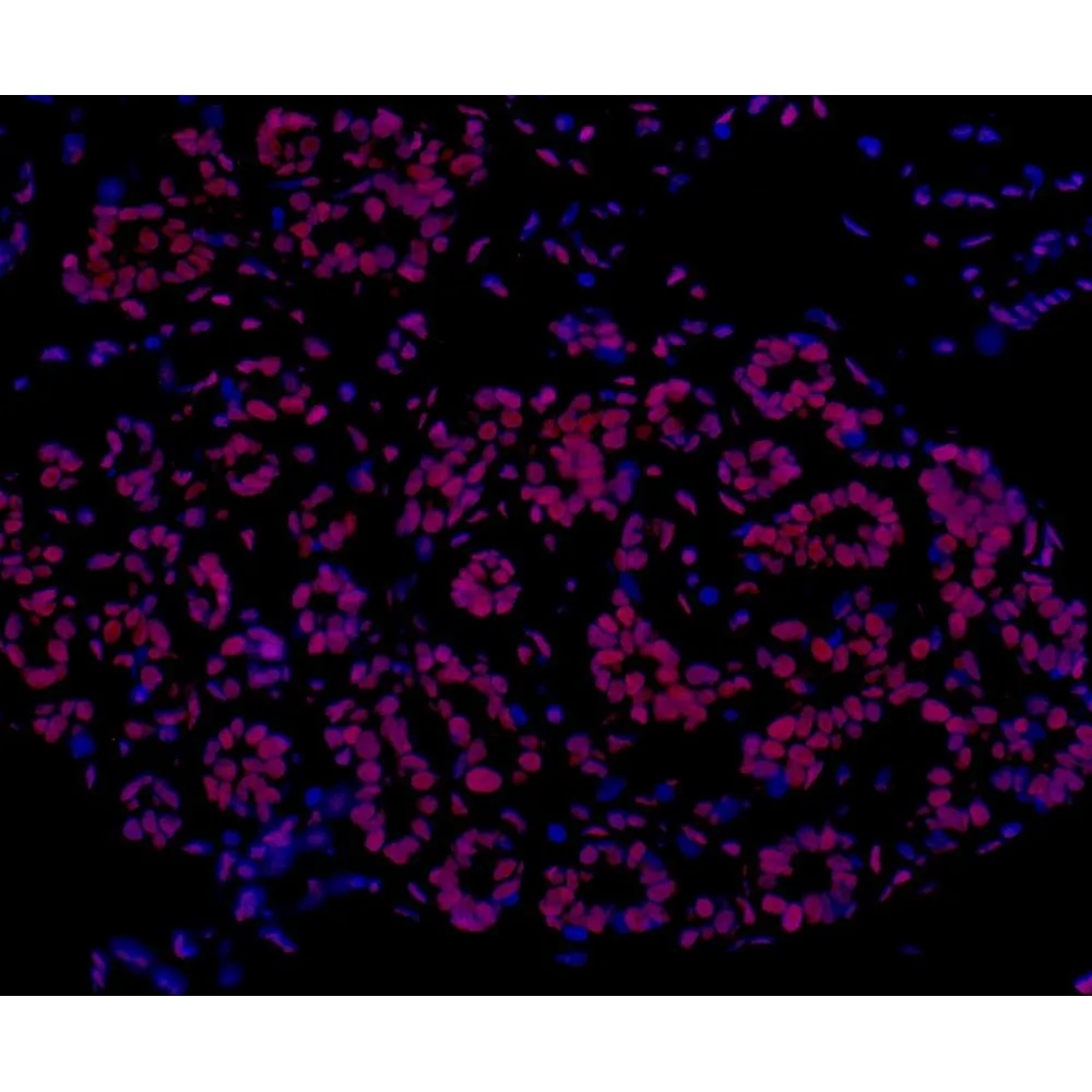 Rabbit anti-FUS Recombinant Monoclonal Antibody [BLR023E]