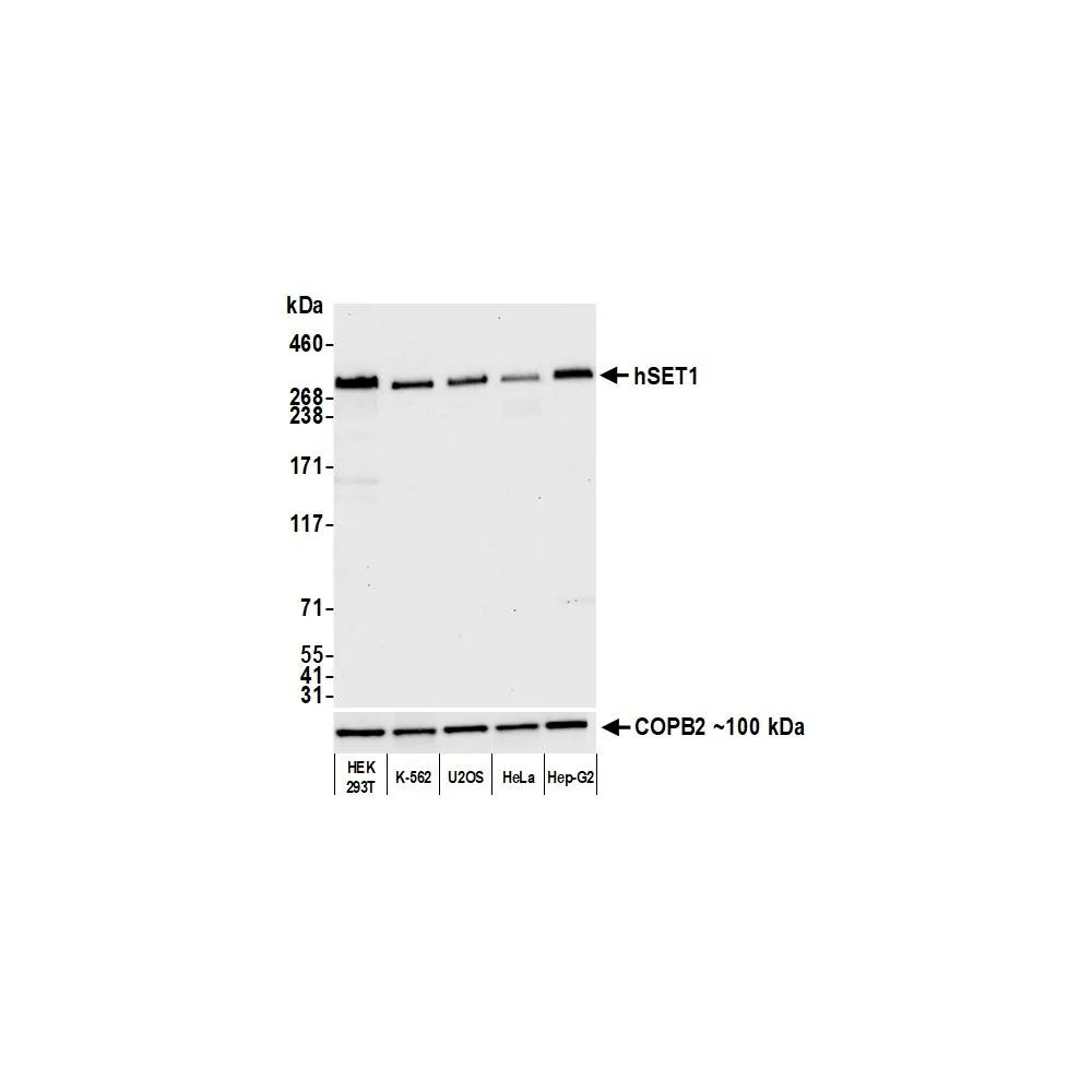 Rabbit anti-hSET1 Recombinant Monoclonal Antibody [BLR024E]