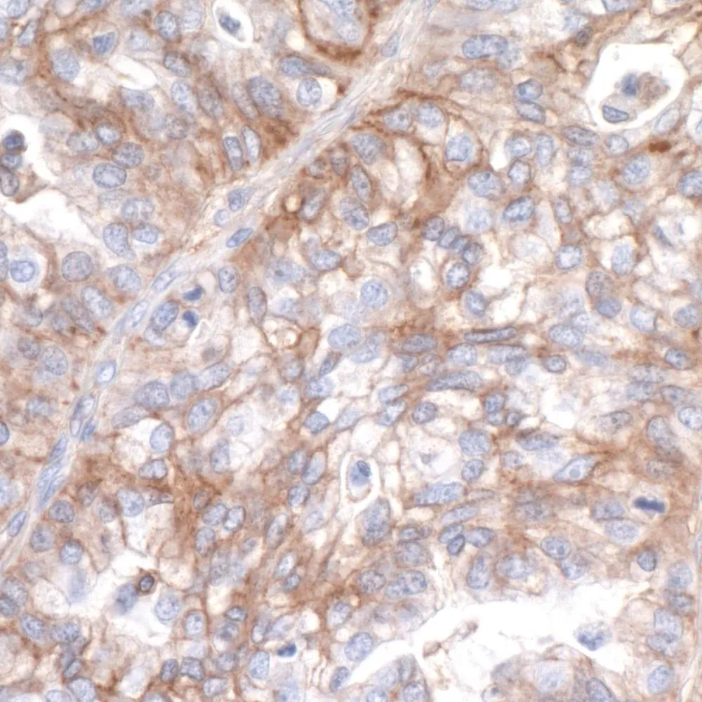 Rabbit anti-B7-H3/CD276  Recombinant Monoclonal Antibody [BLR026F]