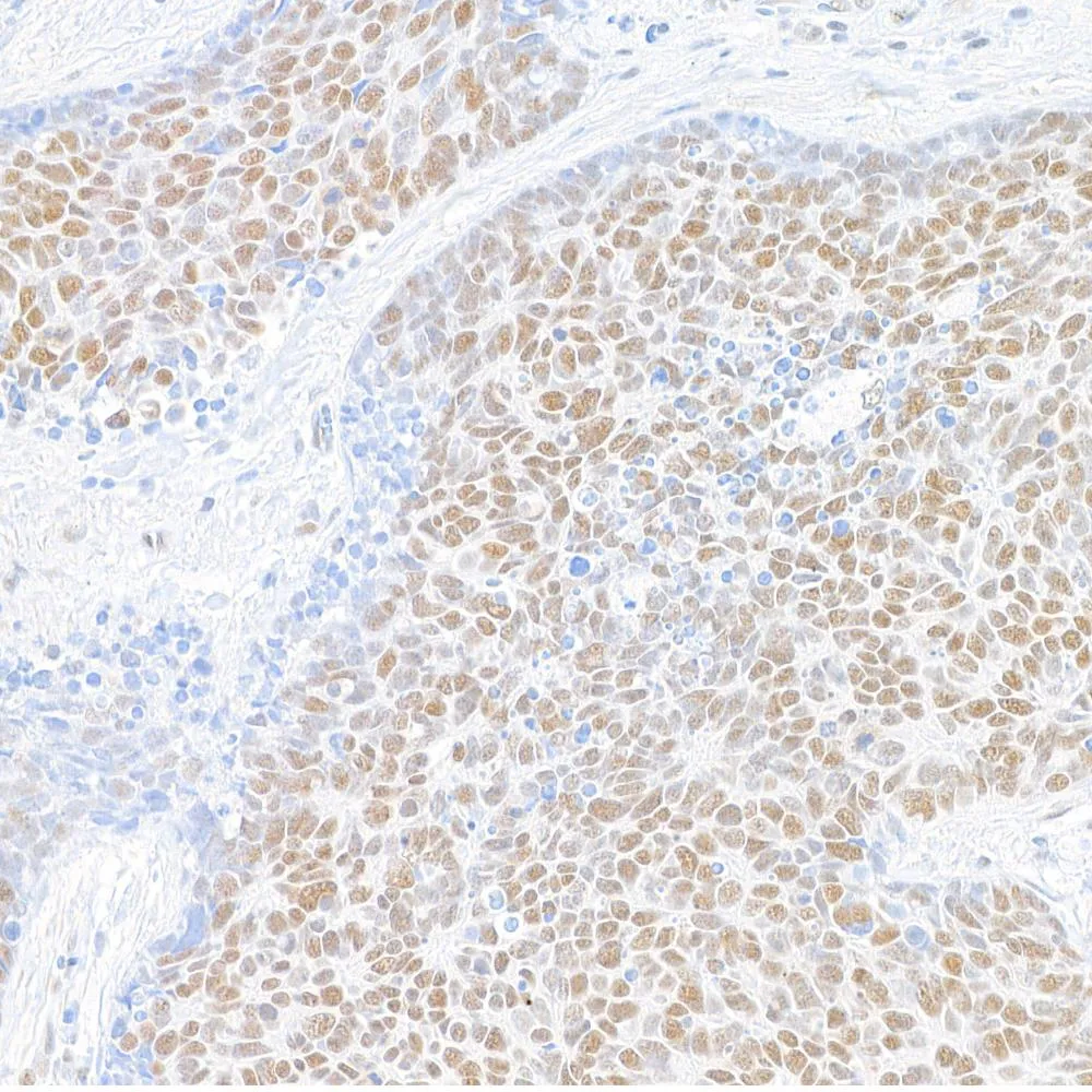 Rabbit anti-MED1 Recombinant Monoclonal Antibody [BLR037F]