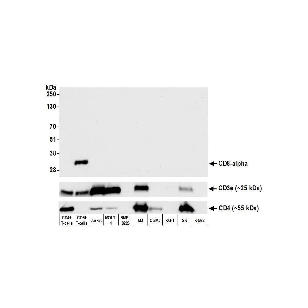 Rabbit anti-CD8 alpha Recombinant Monoclonal Antibody [BLR044F]