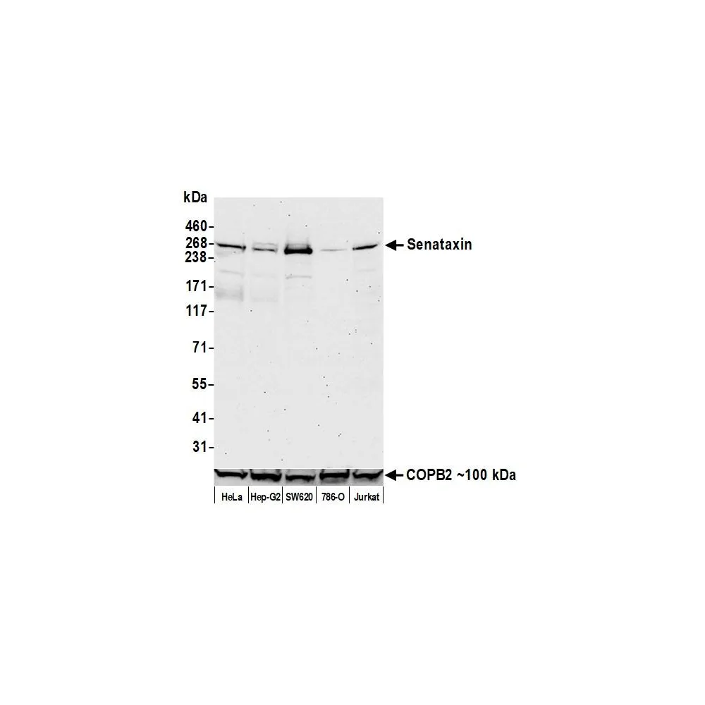 Rabbit anti-Senataxin Recombinant Monoclonal Antibody [BLR050F]