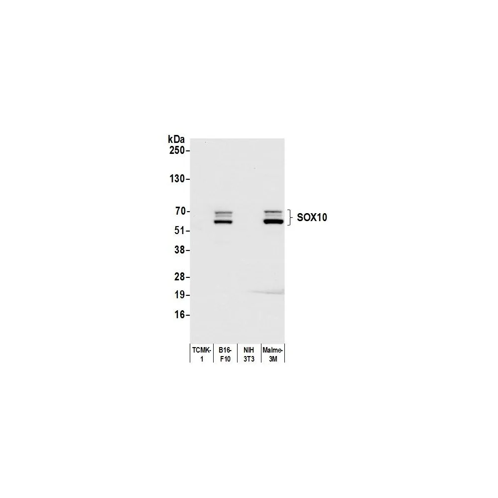 Rabbit anti-SOX10 Recombinant Monoclonal Antibody [BLR080G]