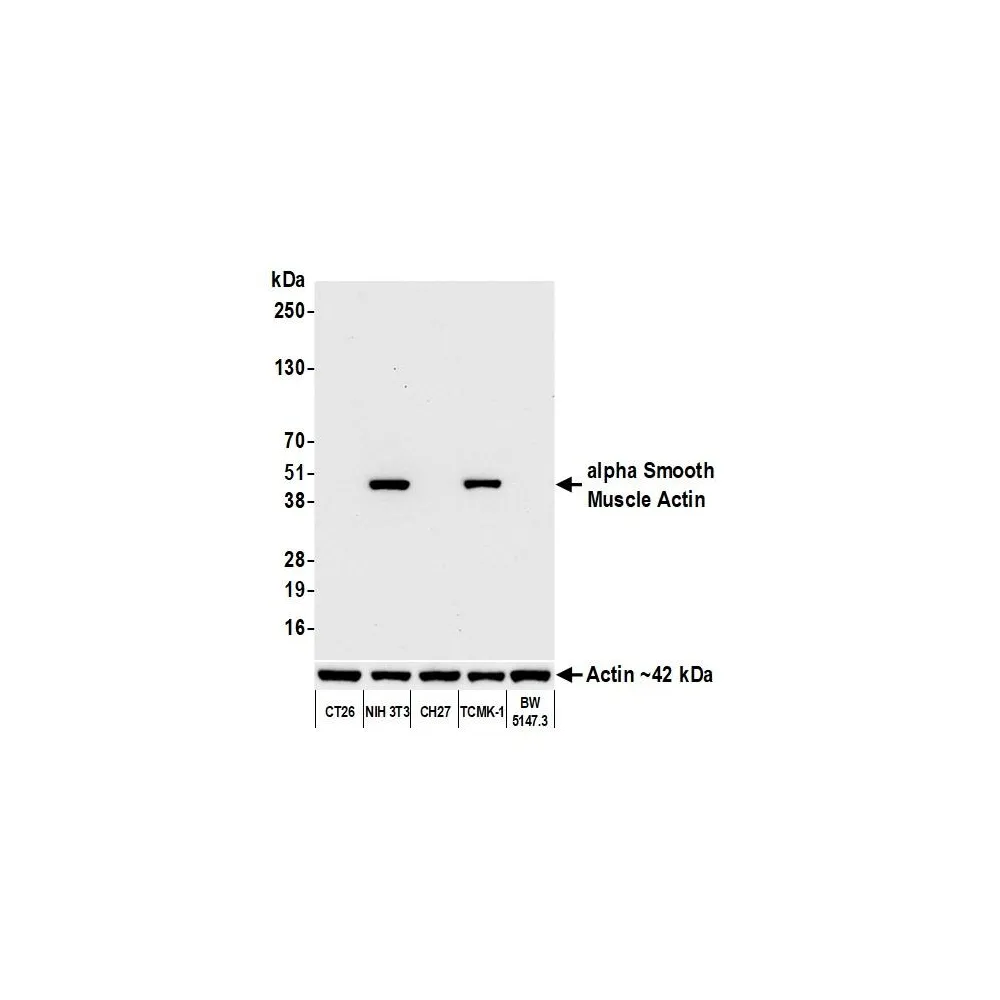 Rabbit anti-alpha Smooth Muscle Actin Recombinant Monoclonal Antibody [BLR082G]