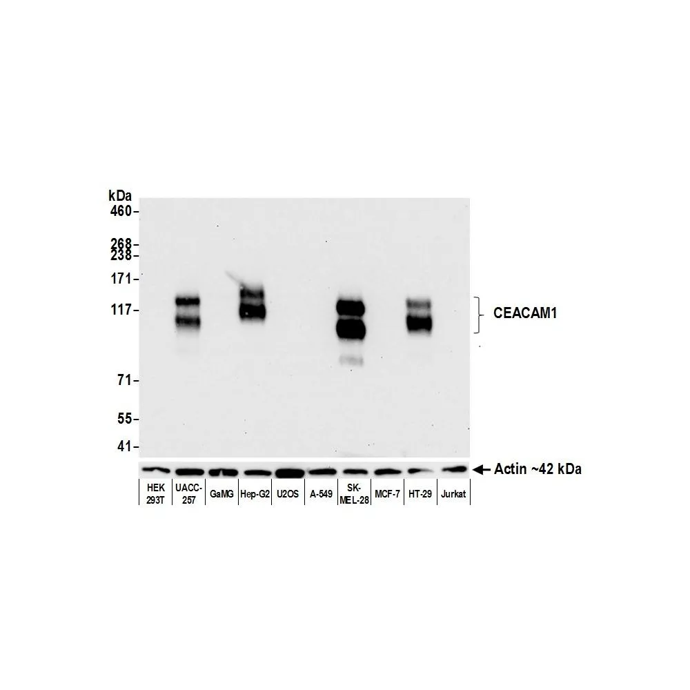 Rabbit anti-CEACAM1 Recombinant Monoclonal Antibody [BLR090G]