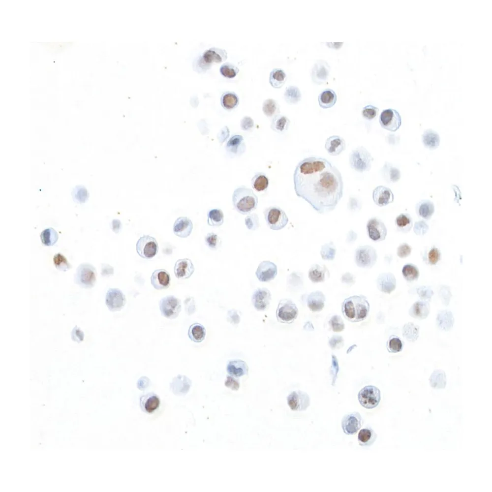 Rabbit anti-ZEB2/SIP Recombinant Monoclonal Antibody [BLR115H]