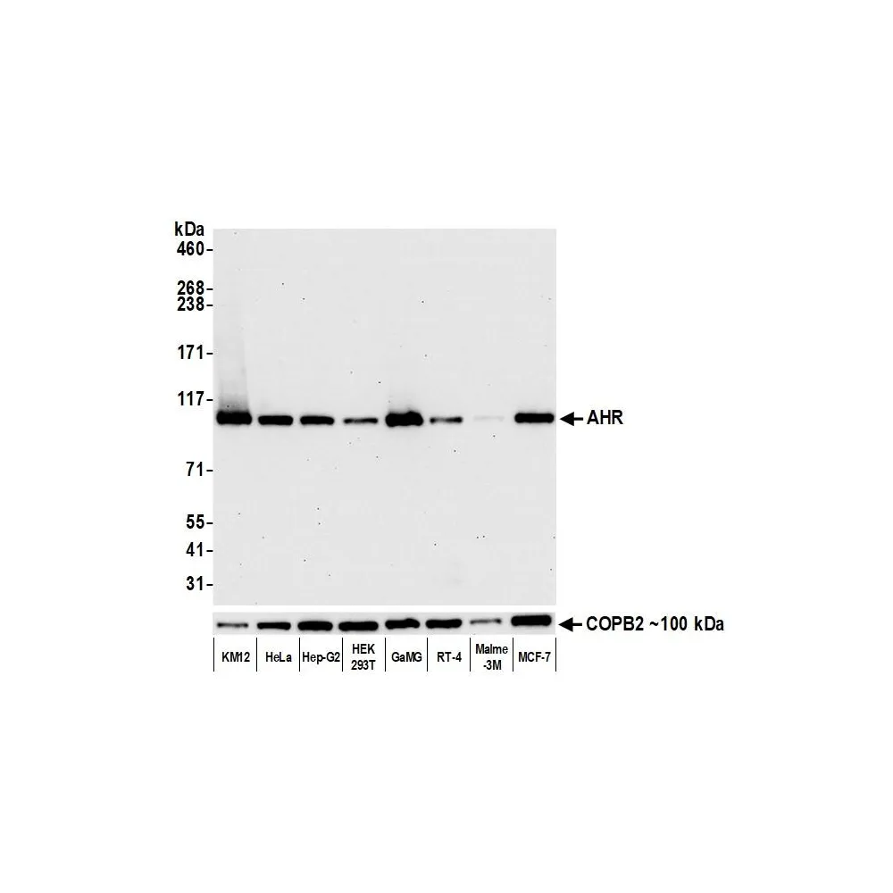 Rabbit anti-AHR Recombinant Monoclonal Antibody [BLR118H]