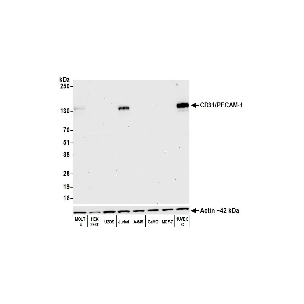Rabbit anti-CD31/PECAM-1 Recombinant Monoclonal Antibody [BLR127H]