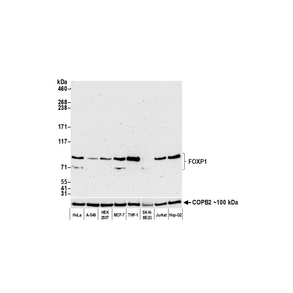 Rabbit anti-FOXP1 Recombinant Monoclonal Antibody [BLR134H]