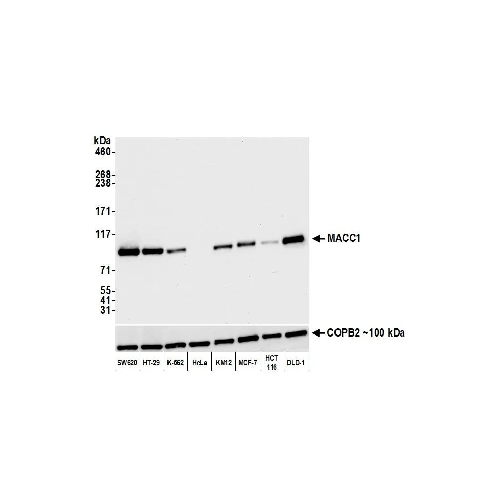 Rabbit anti-MACC1 Recombinant Monoclonal Antibody [BLR135H]