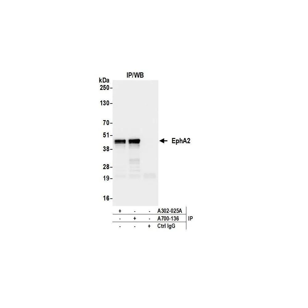 Rabbit anti-EphA2 Recombinant Monoclonal Antibody [BLR136H]