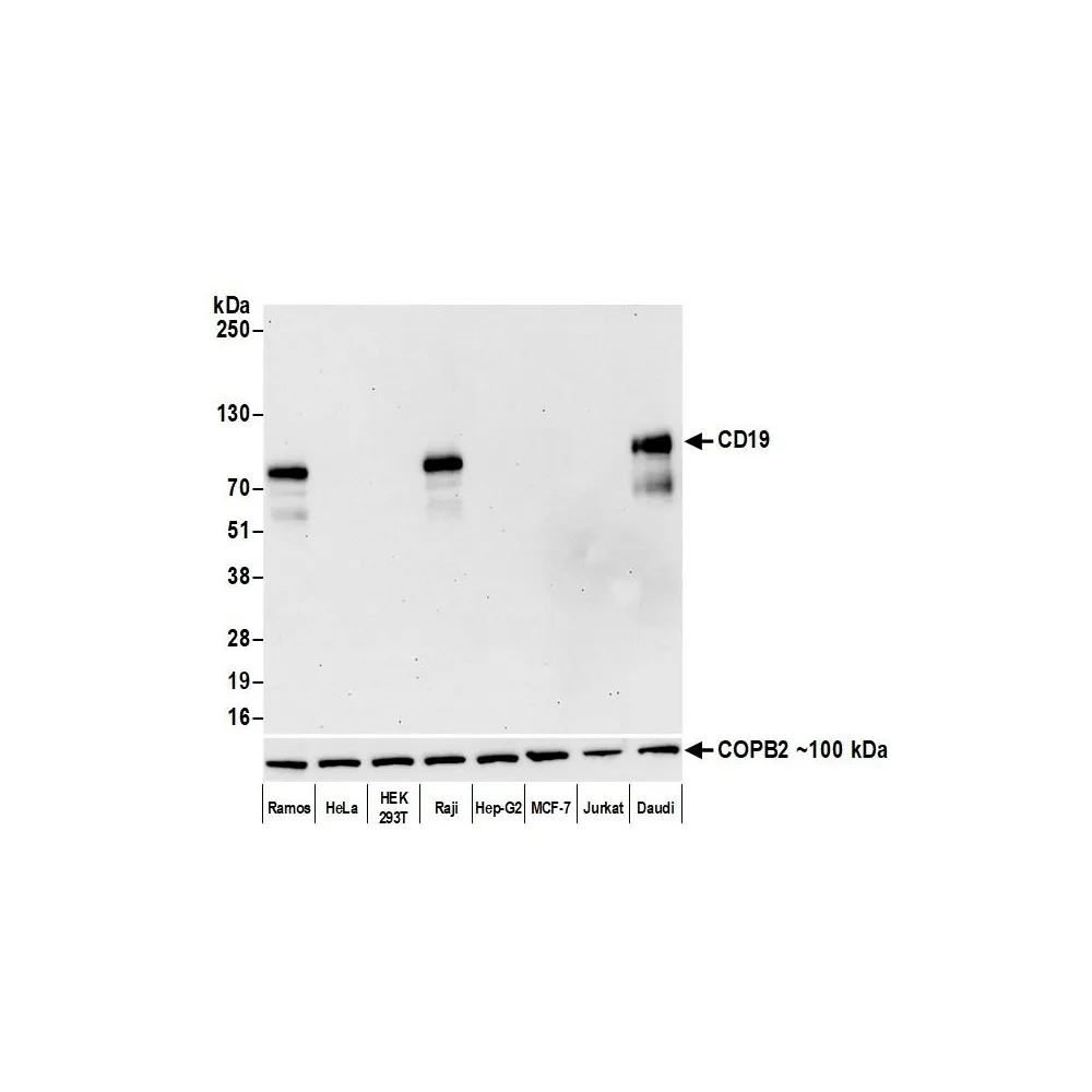 Rabbit anti-CD19 Recombinant Monoclonal Antibody [BLR137H]