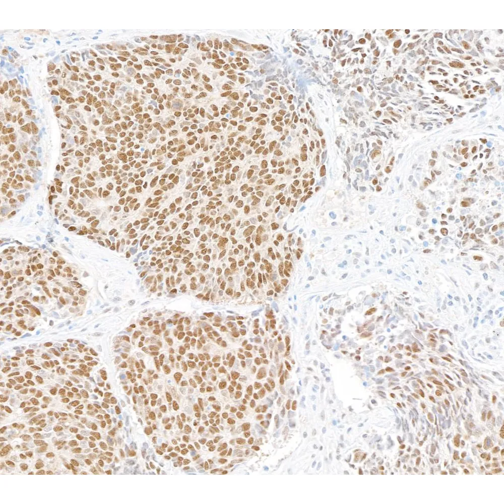 Rabbit anti-UBQLN4/CIP75/Ubiquilin 4 Recombinant Monoclonal Antibody [BLR145J]