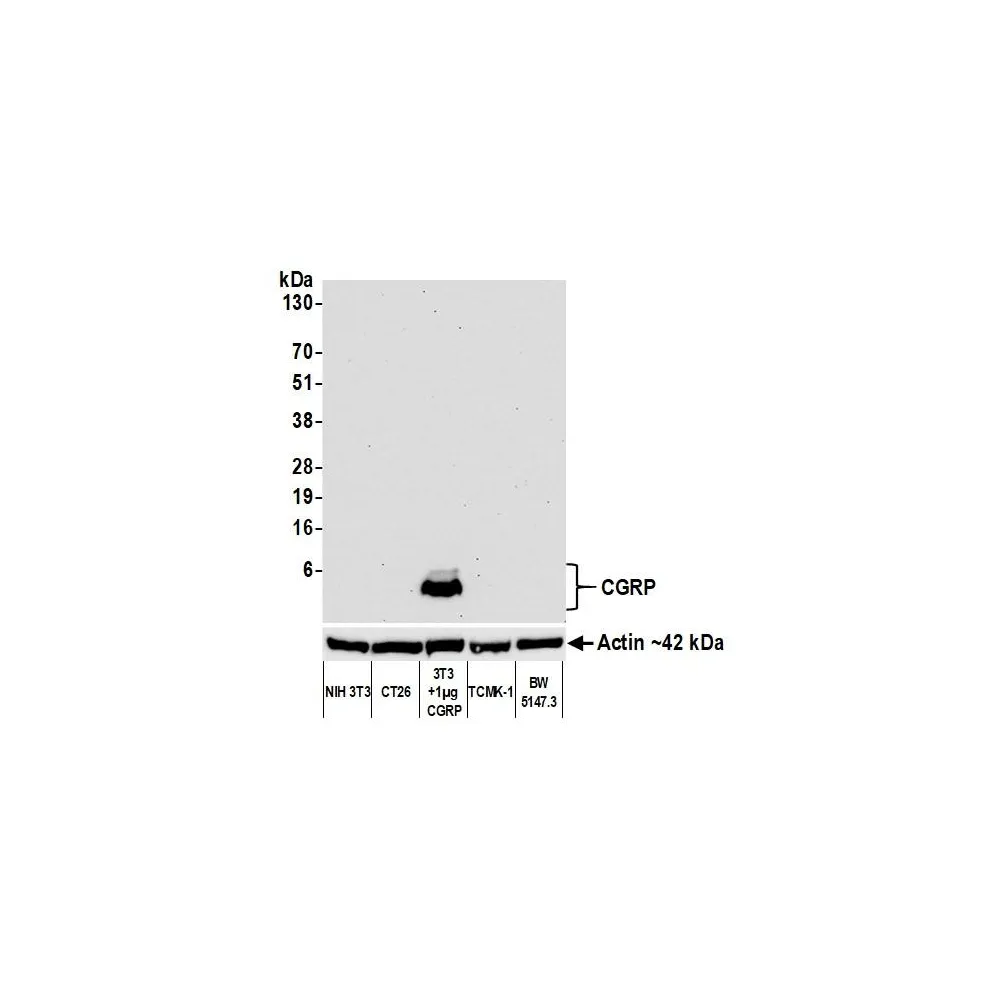 Rabbit anti-CGRP Recombinant Monoclonal Antibody [BLR159J]