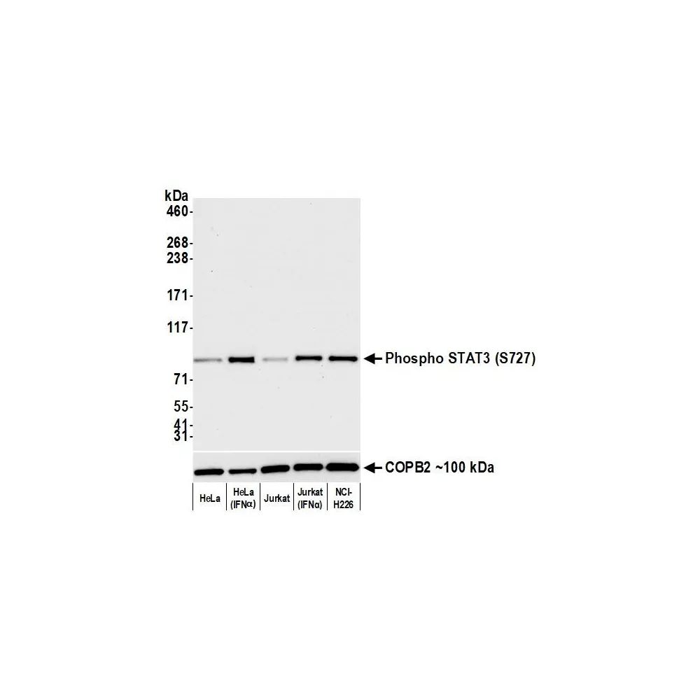 Rabbit anti-Phospho STAT3 (S727) Recombinant Monoclonal Antibody [BLR160J]