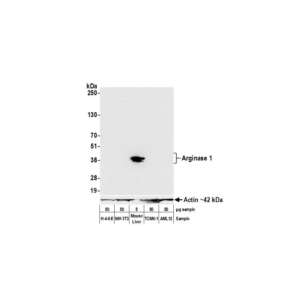 Rabbit anti-Arginase 1 Recombinant Monoclonal Antibody [BLR161J]
