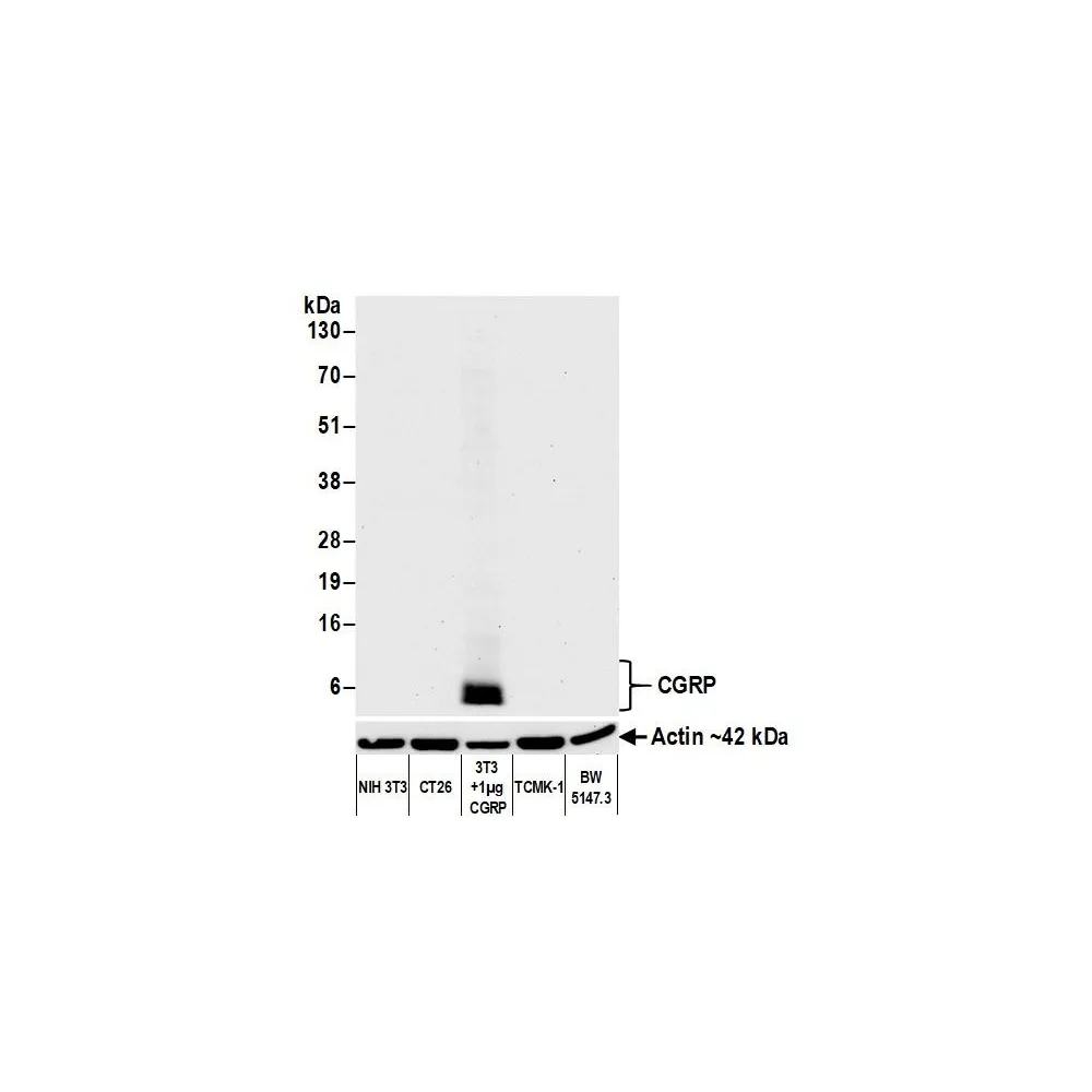 Rabbit anti-CGRP Recombinant Monoclonal Antibody [BLR169J]