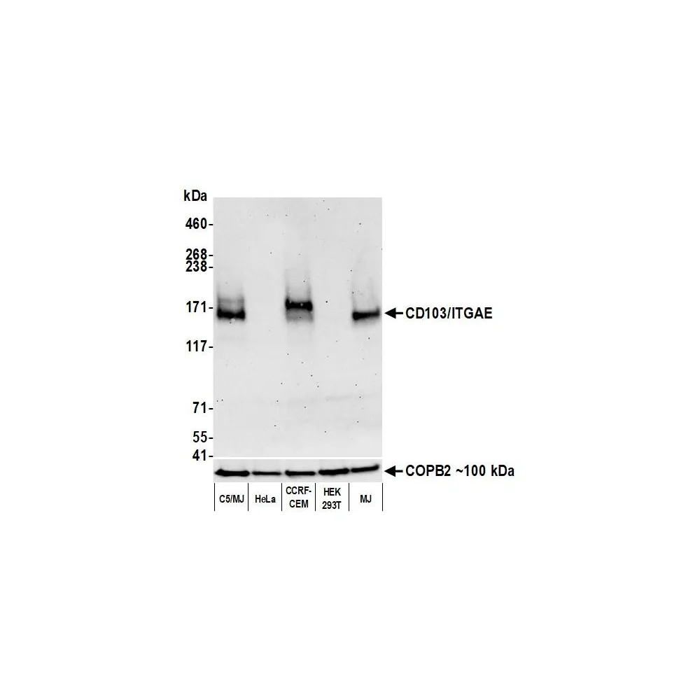 Rabbit anti-CD103/ITGAE Recombinant Monoclonal Antibody [BLR171J]